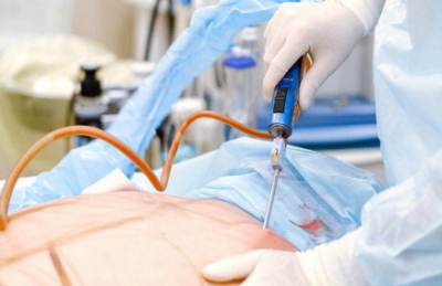Articulații sănătoase – cercetare medicală